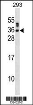 SSX5 Antibody (N-term)