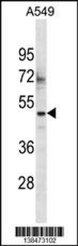 ZSCAN16 Antibody (Center)