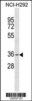 GDF5OS Antibody (C-term)