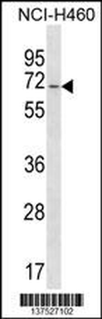 GPATCH4 Antibody (Center)