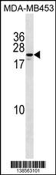 ZNF580 Antibody (Center)