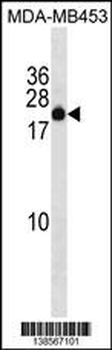 ZNF747 Antibody (C-term)