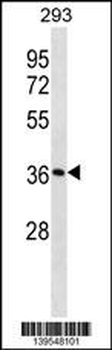 SMN1 Antibody (C-term)