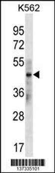 KRT33B Antibody (N-term)