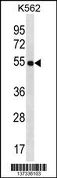 LAX1 Antibody (C-term)