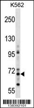 ZNF256 Antibody (Center)