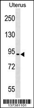 ASTE1 Antibody (N-term)