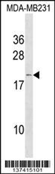 IFNA6 Antibody (C-term)