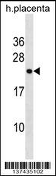 RNF122 Antibody (Center)
