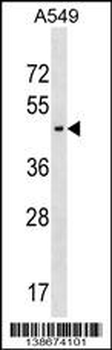 AGPAT5 Antibody (N-term)
