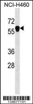 ANKDD1B Antibody (C-term)