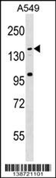 CCDC144C Antibody (C-term)