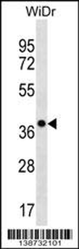 CLCA3P Antibody (Center)