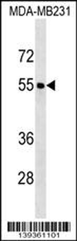 FOXQ1 Antibody (Center)