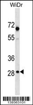 SNX11 Antibody (Center)