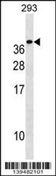 TREM1 Antibody (C-term)