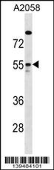 ARHGAP1 Antibody (Center)