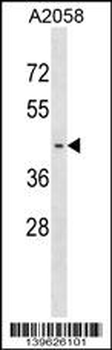PNMA6A Antibody (N-term)