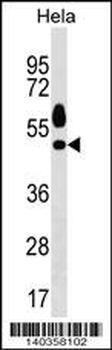 Mouse Sgk1 Antibody (C-term)