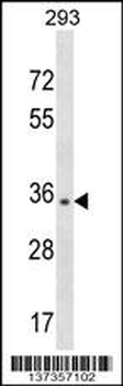 NUBP1 Antibody (Center)