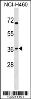 ST6GALNAC4 Antibody (C-term)