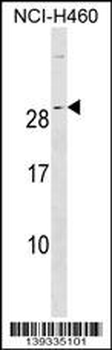 RALA Antibody (C-term)