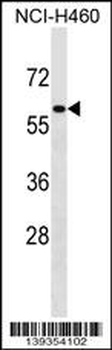 ZNF37A Antibody (N-term)