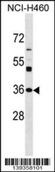 NAT6 Antibody (Center)