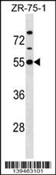 KCNJ1 Antibody (C-term)