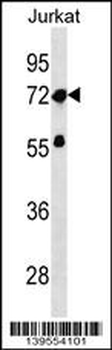 ZNF286A Antibody (Center)