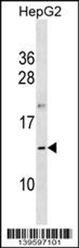OOSP1 Antibody (C-term)