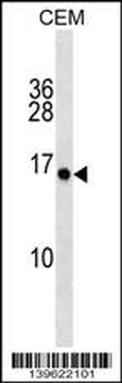 PLGLA Antibody (N-term)