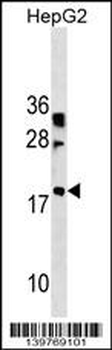 LBX2 Antibody (Center)