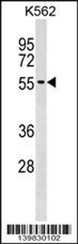 UTP3 Antibody (C-term)