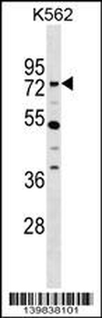 ZNF133 Antibody (N-term)