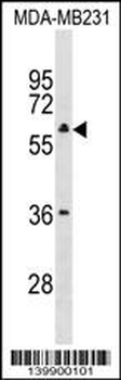 TBC1D10A Antibody (Center)