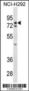 WRNIP1 Antibody (N-term)