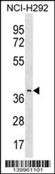 YV012 Antibody (C-term)