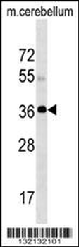 SLC25A20 Antibody (C-term)