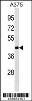 ANKRD63 Antibody (Center)