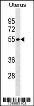 LRRIQ4 Antibody (N-term)