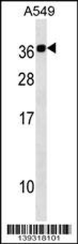 CABP2 Antibody (N-term)
