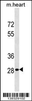HOXB13 Antibody (C-term)