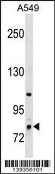 RNF6 Antibody (C-term)