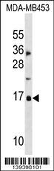 hp16-INK4A Antibody (N-term S7)
