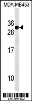 CD300E Antibody (Center)