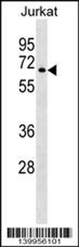 YF005 Antibody (N-term)