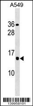 YQ013 Antibody (Center)