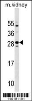 Mouse Tmem125 Antibody (N-term)