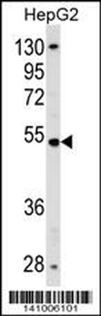 ZNF134 Antibody (N-term)